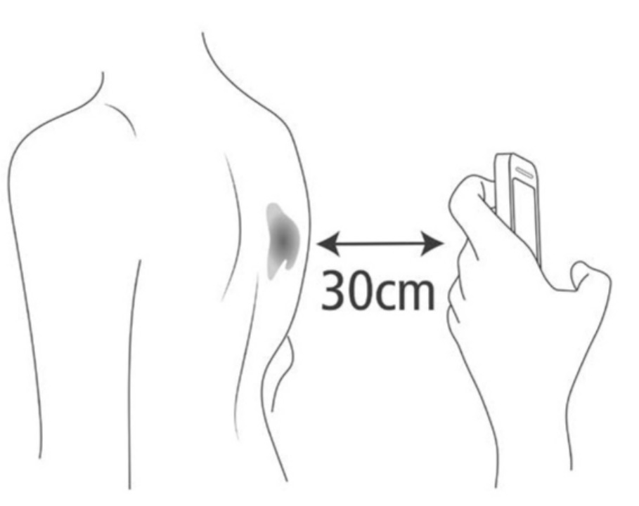 a picture being taken with a smartphone 30cm away from the area of interest