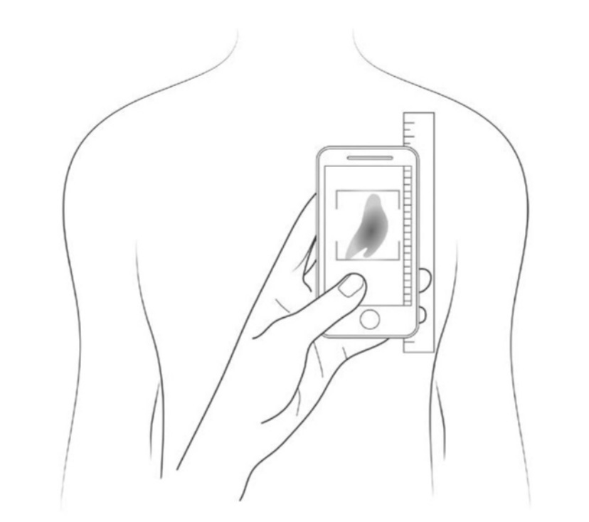 a ruler has been placed next to the area of interest
